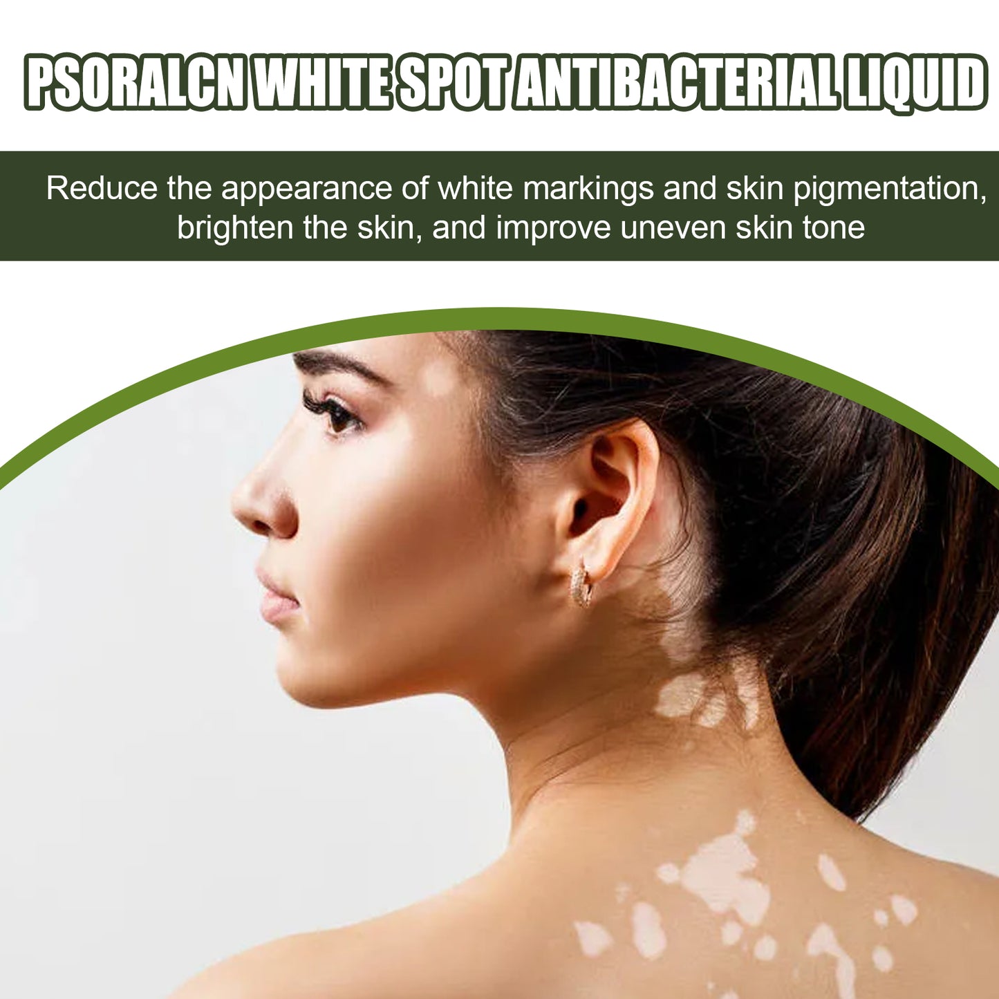 White Spot Purifying Serum For Whitening And Repairing White Spot Spot And Perspiration Spot Skin Moisturizing Serum