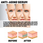Anti-Aging Serum, Lighten Fine Lines On The Face With Line Hydrating Anti-Wrinkle Serum