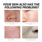 West&Month 3 In 1 Color Correcting Cream, Cover Dark Spots, Moisturize Skin Care And Isolate Foundation